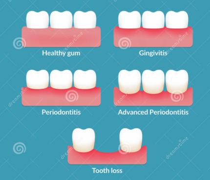 Captura de pantalla 2016-05-31 a la(s) 23.52.07