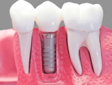 Captura de pantalla 2016-06-01 a la(s) 00.11.59